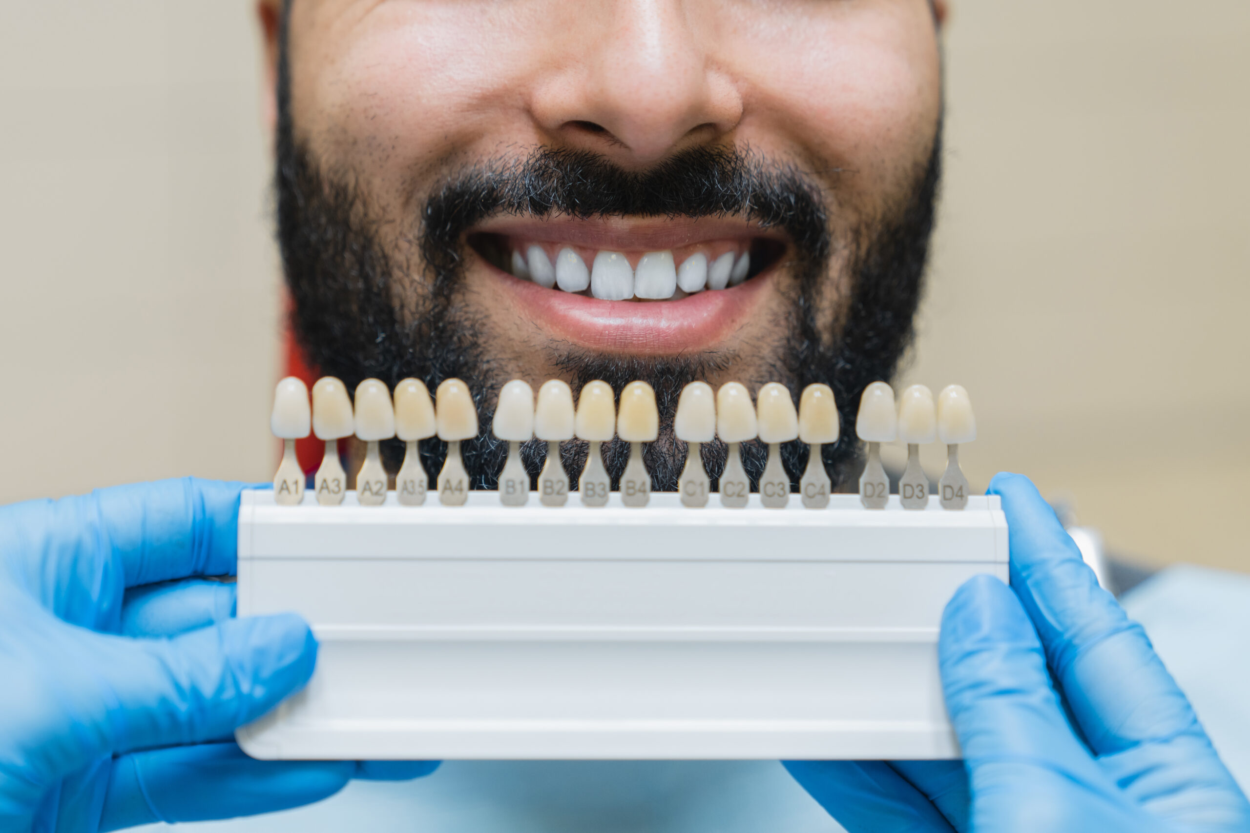dental care implants